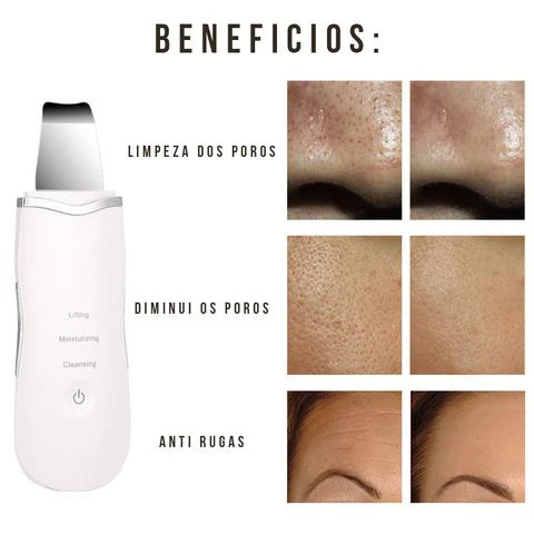 Aparelho de Peeling Ultra Sônico Portátil