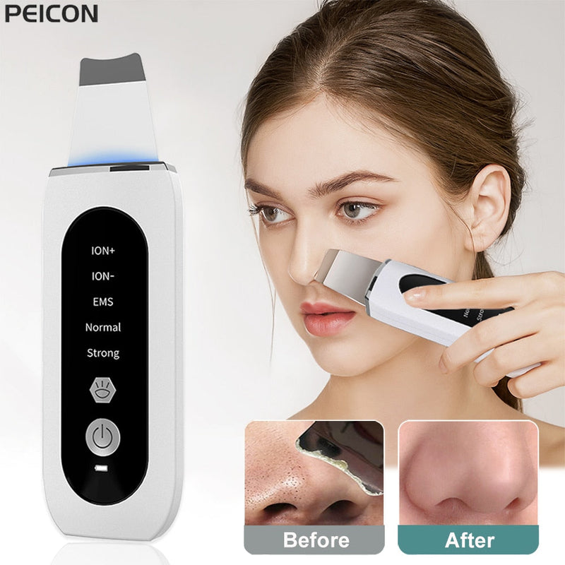 Aparelho de Peeling Ultra Sônico Portátil