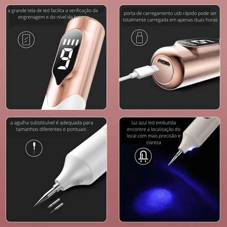 Ultra Caneta de Plasma -Remoção de Verrugas