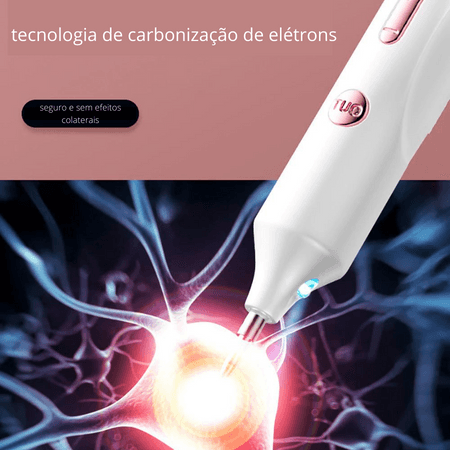 Ultra Caneta de Plasma -Remoção de Verrugas